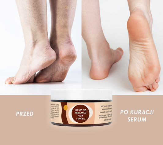 Lullalove Heel & Dry Skin Repair Serum